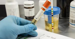 Detect early signs of kidney damage